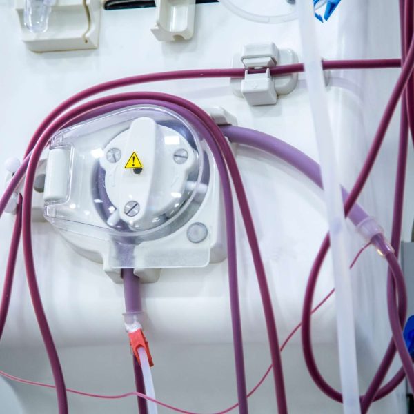 хемодиализа